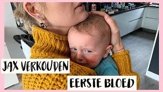 JAX HEEFT EEN BLOEDNEUS  Vlog 422  Diesna Loomans [upl. by Lehcem418]