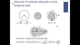 Ecocardiografia Funcion cardiaca [upl. by Feola]