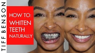 How to Whiten Teeth Naturally with Activated Charcoal [upl. by Akkire]