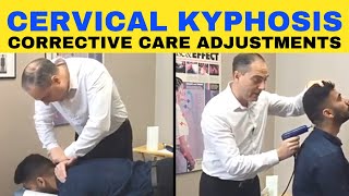 Cervical Kyphosis Corrective Chiropractic Care Adjustments  Dr Walter Salubro [upl. by Nanfa]