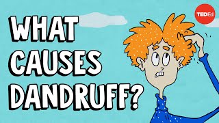 What causes dandruff and how do you get rid of it  Thomas L Dawson [upl. by Anatola]