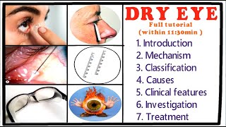 Dry Eye  Full Tutorial [upl. by Nama]