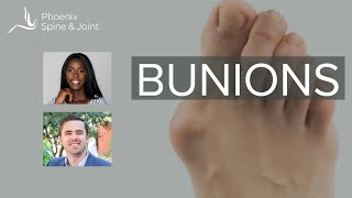 How long after bunion correction does it take to walk without pain [upl. by Kern]