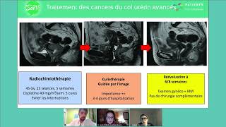 quotRadiothérapie des cancers gynécologiquesquot  Webconférence LinK du 17 janvier 2022 [upl. by Annal]