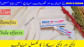 SkinA Cream Uses Benefits and Side effects Review  How to use SkinA cream  Tretinoin 005 [upl. by Ivad]