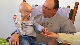 Progeria clinical trial at Boston Childrens Hospital [upl. by Armil]