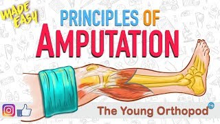 Amputation Principles  ANIMATION  BASICS  NEET PG  Amputee  The Young Orthopod [upl. by Kalinda201]