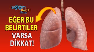 Akciğer Kanseri Kimlerde Görülür Belirtileri Nelerdir [upl. by Notxap510]