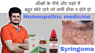 Syringoma  आंखों के नीचे और चहरे में बहुत छोटे दाने  Homeopathic Medicine  Effective Medicine [upl. by Leahsim]