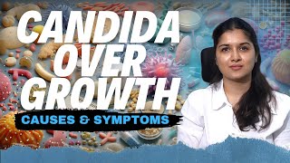 Candida Overgrowth Causes Risk Factors and How to Keep It in Check  Dt Vineesha Reddy [upl. by Etnahc19]