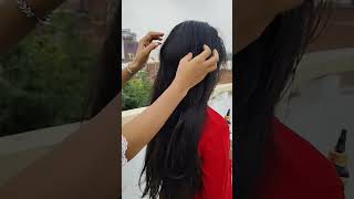 Vedix hair growth kit unboxing vedix haircare  hair growth  aayurvedic tranding song👍 [upl. by Eahsan]