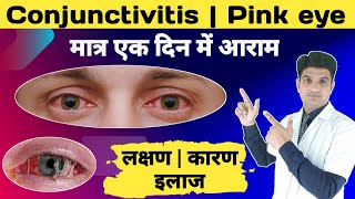 Eye infection आखों का चिपकना का इलाज  Conjunctivitis treatment [upl. by Auqcinahs762]