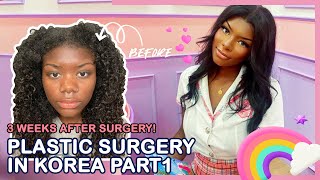 Jaylyns ethnic nose job Rhinoplasty and Facial Contouring Journey  Braun Plastic Surgery Korea [upl. by Midge]