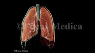 Hemothorax  Lungs [upl. by Torp]