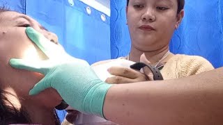 PERIAPICAL XRAY PAANO GINAGAWA RAW VIDEO [upl. by Cleodal892]