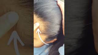 3 Tips that can Fix your RECEDING HAIRLINE  Receding Hairline TRANSFORMATION [upl. by Akcinat]