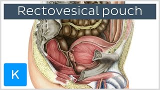 Rectovesical pouch Excavatio rectovesicalis  Human Anatomy  Kenhub [upl. by Yehc]