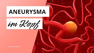 Aneurysma im Kopf Diese Symptome sind Warnzeichen [upl. by Iline465]