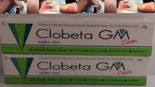 Clobeta GM Cream Clobetasol Propionate Neomycin Sulphate Miconazole Nitrate Zinc Oxide Cream [upl. by Dafna]