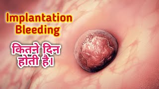 Implantation Bleeding कितने दिन तक होती है।।Implantation Bleeding।।NainaHealth555 [upl. by Eberle]