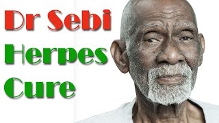 Dr Sebi Herpes Treatment  Natural Treatment For Herpes By Dr Sebi [upl. by Olga397]