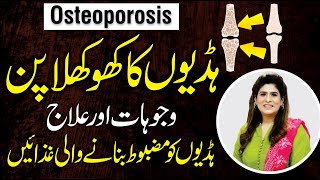 Osteoporosis Causes Symptoms and Treatment  Best Food for Osteoporosis  Dr Fareeha Tariq [upl. by Liane]