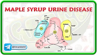 Maple Syrup Urine Disease  Pathophysiology Clinical features Diagnosis  Treatment  USMLE Step 1 [upl. by Ihskaneem]