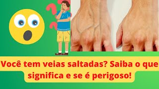 Você tem as VEIAS das mãos SALTADAS Saiba o que isso SIGNIFICA e se é perigoso [upl. by Diskson54]