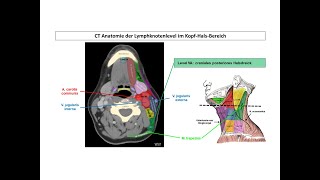 CT Anatomie der Lymphknotenlevel im KopfHalsBereich  Strahlentherapie Prof Hilke Vorwerk [upl. by Emilee]