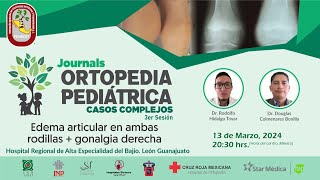 Journal Ortopedia Pediátrica Edema articular en ambas rodillas  gonalgia derecha [upl. by Marylou]