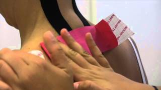 Kinesiotaping in der Physiotherapie Potsdam [upl. by Thorvald249]