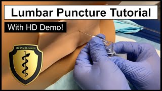 Lumbar Puncture Spinal Tap  Comprehensive Tutorial amp Demonstration [upl. by Romilda]