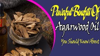 Powerful Benefits Of Agarwood Oil You Should Know About  Useful info [upl. by Archy607]