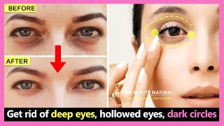 How to get rid of deep eyes hollowed eyes dark circles and wrinkles under the eyes  Eye exercises [upl. by Krystin]