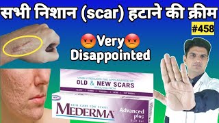 10 Best Acne Scars Removal Creams for Face 2019  Also Fade Dark Spots Sun Spots Tan Wrinkles etc [upl. by Sikorski520]