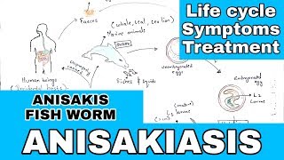 Anisakiasis  Anisakis  Life cycle symptoms treatment  By phanindra gupta [upl. by Anelleh276]