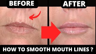 SMOKER LINES  HOW TO GET RID OF LIP WRINKLES  FACE YOGA AND FACE MASSAGE [upl. by Syned]