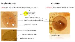 Balantidium coli [upl. by Cheria]