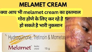 Melamet cream usesbenefits and side effects [upl. by Hughes]