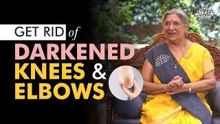 How To Lighten Your Knees Elbows and Armpits with this 5 Natural Home Remedies  Natural Skin Tips [upl. by Iek986]