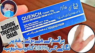 Burning Treatment jale Huwe Zakham or unke Nishant Khatam 100 Quench Cream Benefits UrduHindi [upl. by Laamak]