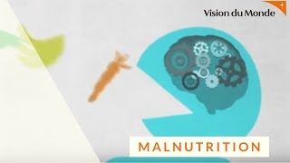 Un clic pour comprendre la malnutrition [upl. by Daukas139]