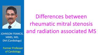 Differences between rheumatic mitral stenosis and radiation associated MS [upl. by Der884]