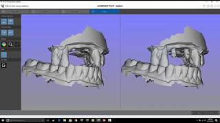 Carestream 3600  Scan Body Locking Feature [upl. by Nohsyt]