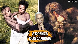 Kuru a doença canibal que quase exterminou uma tribo da Oceania [upl. by Zenitram]