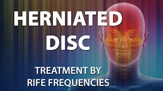 Herniated Disc Disk  RIFE Frequencies Treatment  Energy amp Quantum Medicine with Bioresonance [upl. by Azilem]