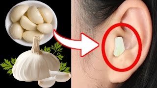 Put Garlic In Your Ear For 30 minutes And See what happens Next [upl. by Sisak]