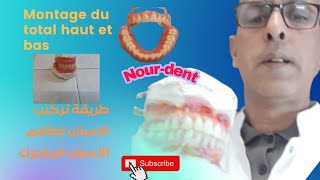 Montage du total haut et bas طريقة تركيب الاسنان لطاقم المتحرك للفك العلوي والسفلي [upl. by Ecyt19]