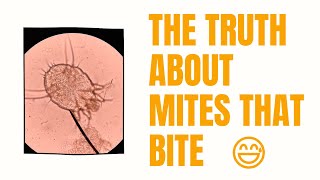 The Truth About Mites that Bite With Examples [upl. by Tonl360]