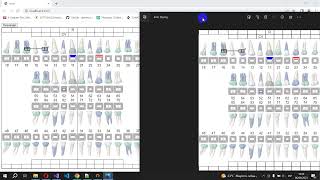 Simulación de odontograma con HTML y Javascript [upl. by Ahteres357]